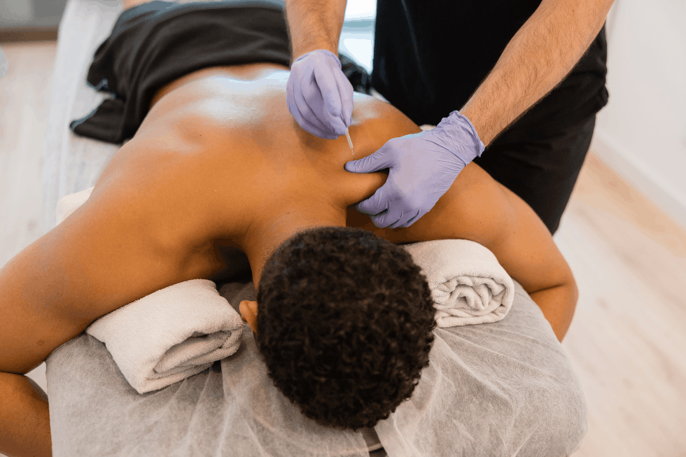 Trigger Point Dry Needling-min